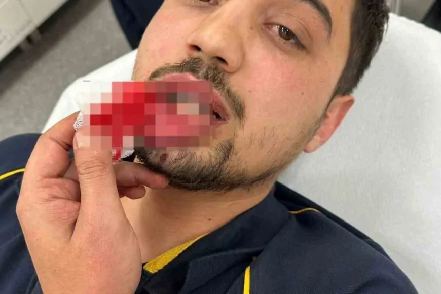 Bursa’da ambulans şoförü darp edildi